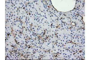 Image no. 1 for anti-Alcohol Dehydrogenase 1B (Class I), beta Polypeptide (ADH1B) antibody (ABIN1496479) (ADH1B anticorps)