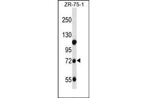 Western blot analysis of Beta-glucuronidase Antibody (C-term) in ZR-75-1 cell line lysates (35ug/lane). (Glucuronidase beta anticorps  (C-Term))
