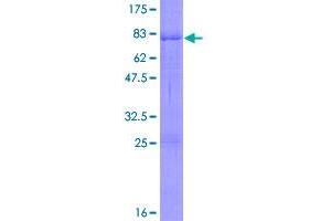 Image no. 1 for Casein Kinase 1, delta (CSNK1D) (AA 1-415) protein (GST tag) (ABIN1350534)