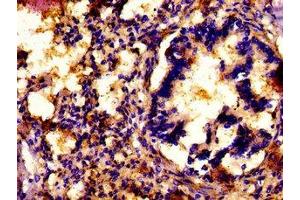 IHC image of ABIN7154307 diluted at 1: 500 and staining in paraffin-embedded human lung tissue performed on a Leica BondTM system. (ATP7A anticorps  (AA 257-488))