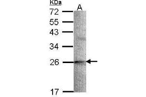 WB Image Sample (30 ug of whole cell lysate) A: A549 12% SDS PAGE antibody diluted at 1:1000 (STMN2 anticorps  (N-Term))