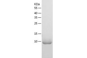 Western Blotting (WB) image for TP53 Regulated Inhibitor of Apoptosis 1 (TRIAP1) (AA 1-76) protein (His-IF2DI Tag) (ABIN7125421)
