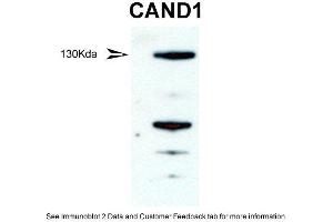 WB Suggested Anti-CAND1 Antibody  Titration: 1 ug/ml Positive Control: mouse testis (CAND1 anticorps  (Middle Region))