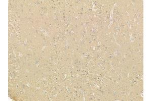 ABIN6257616 and ABIN6275245 at 1/100 staining human glioblastoma by IHC-P. (MRPL49 anticorps  (Internal Region))