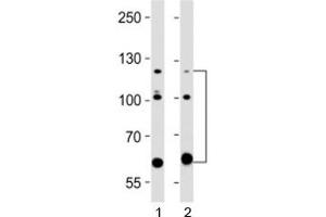 Western blot testing of ABL2 antibody at 1:2000 dilution. (ABL2 anticorps)