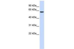 Image no. 1 for anti-serine Palmitoyltransferase, Long Chain Base Subunit 1 (SPTLC1) (AA 216-265) antibody (ABIN6740984) (SPTLC1 anticorps  (AA 216-265))