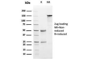 SDS-PAGE Analysis Purified Progesterone Receptor Mouse Monoclonal Antibody (PGR/2694).