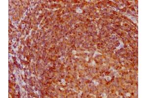 IHC image of ABIN7127421 diluted at 1:97. (Recombinant CDKN1B anticorps)