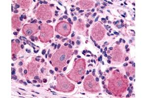 Anti-5HT1D Receptor antibody IHC of human spinal cord, dorsal root ganglion.