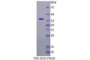 SDS-PAGE analysis of Human TCEA3 Protein. (TCEA3 Protéine)