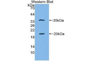 Western Blotting (WB) image for anti-serine Peptidase Inhibitor, Kazal Type 5 (SPINK5) (AA 699-976) antibody (ABIN1860613) (SPINK5 anticorps  (AA 699-976))