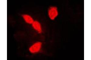 Immunofluorescent analysis of hnRNP A1 staining in K562 cells. (HNRNPA1 anticorps  (Center))