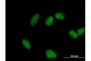 Immunofluorescence of purified MaxPab antibody to FHL3 on HeLa cell.