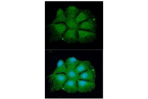 ICC/IF analysis of CDKN1b in Hep3B cells line, stained with DAPI (Blue) for nucleus staining and monoclonal anti-human CDKN1b antibody (1:100) with goat anti-mouse IgG-Alexa fluor 488 conjugate (Green).