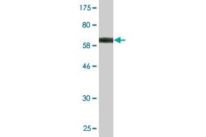 Western Blot detection against Immunogen (61.