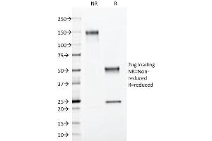 SDS-PAGE Analysis Purified S100B Mouse Monoclonal Antibody (4C4.