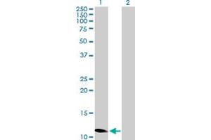 Western Blot analysis of ZNF695 expression in transfected 293T cell line by ZNF695 MaxPab polyclonal antibody. (ZNF695 anticorps  (AA 1-133))