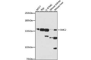 Western blot analysis of extracts of various cells, using SMC2 antibody (ABIN7270615) at 1:1000 dilution. (SMC2 anticorps  (AA 700-900))