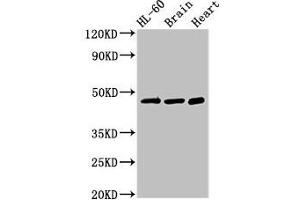 Western Blot Positive WB detected in: HL60 whole cell lysate, Mouse brain tissue, Rat heart tissue All lanes: CHST1 antibody at 3 μg/mL Secondary Goat polyclonal to rabbit IgG at 1/50000 dilution Predicted band size: 47 kDa Observed band size: 47 kDa (CHST1 anticorps  (AA 305-397))