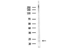 Western blot analysis of lysates from Mouse testis, using R Antibody at 1/1000 dilution.