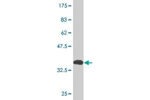 Western Blot detection against Immunogen (37.