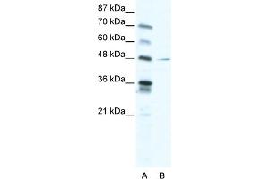 WB Suggested Anti-NFIC Antibody Titration:  2. (NFIC anticorps  (C-Term))