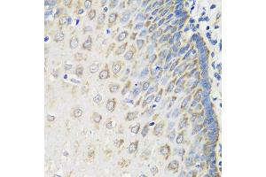 Immunohistochemistry of paraffin-embedded human esophagus using MSRB2 antibody at dilution of 1:100 (40x lens). (MSRB2 anticorps)