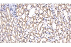 Detection of SFRP1 in Rat Kidney Tissue using Polyclonal Antibody to Secreted Frizzled Related Protein 1 (SFRP1) (SFRP1 anticorps  (AA 8-153))