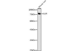 Western blot analysis of extracts of Mouse liver, using IL6R antibody (ABIN3015521, ABIN3015522, ABIN3015523, ABIN1680455 and ABIN6218635) at 1:1000 dilution. (IL-6 Receptor anticorps  (AA 20-320))
