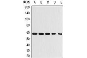Western blot analysis of Beclin-1 expression in A431 (A), MCF7 (B), Raji (C), mouse kidney (D), rat brain (E) whole cell lysates. (Beclin 1 anticorps)