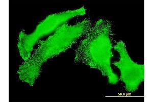 Immunofluorescence of monoclonal antibody to TAOK3 on HeLa cell. (TAO Kinase 3 anticorps  (AA 809-898))