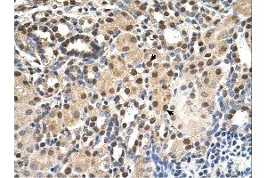 Immunohistochemistry (IHC) image for anti-Acidic (Leucine-Rich) Nuclear phosphoprotein 32 Family, Member E (ANP32E) (Middle Region) antibody (ABIN2782591)