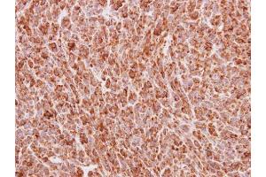 IHC-P Image Immunohistochemical analysis of paraffin-embedded MDA-MB468 xenograft, using BMP4, antibody at 1:100 dilution. (BMP4 anticorps)