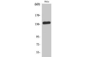 Western Blot (WB) analysis of HeLa cells using E-cadherin Polyclonal Antibody.