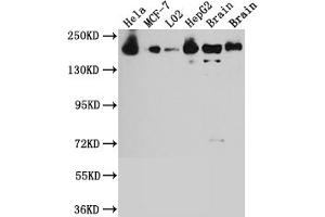 Western Blot Positive WB detected in: Hela whole cell lysate, MCF-7 whole cell lysate, L02 whole cell lysate, HepG2 whole cell lysate, Mouse Brain whole cell lysate, Rat Brain whole cell lysate All lanes: ROCK2 antibody at 1:1000 Secondary Goat polyclonal to rabbit IgG at 1/50000 dilution Predicted band size: 161 kDa Observed band size: 161 kDa (Recombinant ROCK2 anticorps)