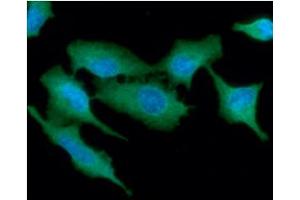 ICC/IF analysis of TP53I3 in A549 cells line, stained with DAPI (Blue) for nucleus staining and monoclonal anti-human TP53I3 antibody (1:100) with goat anti-mouse IgG-Alexa fluor 488 conjugate (Green).