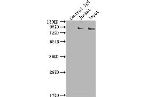 Immunoprecipitating SUZ12 in K562 whole cell lysate Lane 1: Rabbit control IgG instead of ABIN7127832 in K562 whole cell lysate.