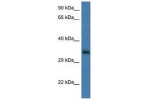 Image no. 1 for anti-Glucosamine-6-Phosphate Deaminase 1 (GNPDA1) (AA 50-99) antibody (ABIN6747378) (GNPDA1 anticorps  (AA 50-99))