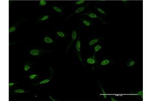 Immunofluorescence of monoclonal antibody to XPA on HeLa cell. (XPA anticorps  (AA 1-273))