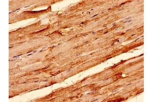 Immunohistochemistry analysis of human skeletal muscle tissue using ABIN7170123 at dilution of 1:100