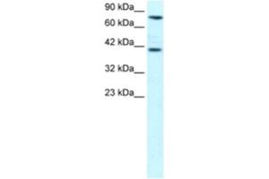 Western Blotting (WB) image for anti-Zinc Finger Protein 652 (ZNF652) antibody (ABIN2460271) (ZNF652 anticorps)