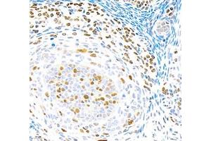 Immunohistochemistry of paraffin embedded rat ovary using Top2 (ABIN7075937) at dilution of 1:5000 (400x lens)