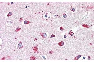 Detection of HEXb in Human Cerebrum Tissue using Polyclonal Antibody to Hexosaminidase B Beta (HEXb) (HEXB anticorps  (AA 294-435))
