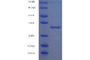 SDS-PAGE (SDS) image for ST8 alpha-N-Acetyl-Neuraminide alpha-2,8-Sialyltransferase 4 (ST8SIA4) (AA 21-168) protein (His-SUMO Tag) (ABIN5711531)