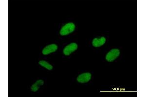 Immunofluorescence of purified MaxPab antibody to C20orf67 on HeLa cell.