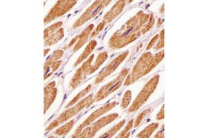 (ABIN391039 and ABIN2841206) staining PDK4 in human heart tissue sections by Immunohistochemistry (IHC-P - paraformaldehyde-fixed, paraffin-embedded sections). (PDK4 anticorps  (C-Term))