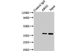 Immunoprecipitating ARG2 in HEK293 whole cell lysate Lane 1: Rabbit control IgG (1 μg) instead of ABIN7144586 in HEK293 whole cell lysate. (ARG2 anticorps  (AA 1-354))