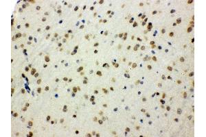 Anti- SHC1 Picoband antibody, IHC(P) IHC(P): Mouse Brain Tissue
