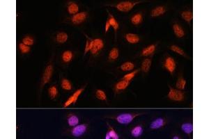 Immunofluorescence analysis of U2OS cells using OTUB1 Polyclonal Antibody at dilution of 1:100. (OTUB1 anticorps)
