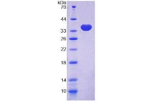 SDS-PAGE analysis of Human TLN2 Protein. (TLN2 Protéine)